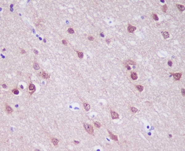 IHC - Anti-PGP9.5 Rabbit Monoclonal Antibody ABO13863